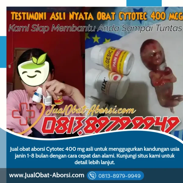 Obat Aborsi Cytotec Asli 400 mg: Solusi Aman dan Efektif untuk Mengatasi Kehamilan yang Tidak Diinginkan