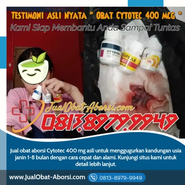 Obat Aborsi Cytotec Asli 400 mg: Solusi Aman dan Efektif untuk Mengatasi Kehamilan yang Tidak Diinginkan