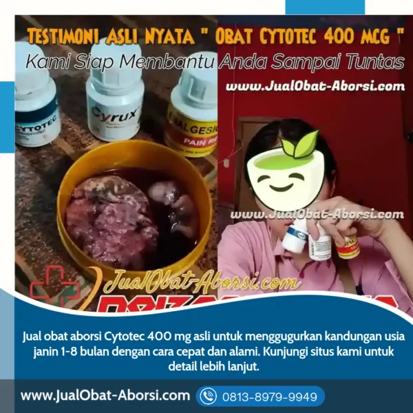 Obat Aborsi Cytotec Asli 400 mg: Solusi Aman dan Efektif untuk Mengatasi Kehamilan yang Tidak Diinginkan