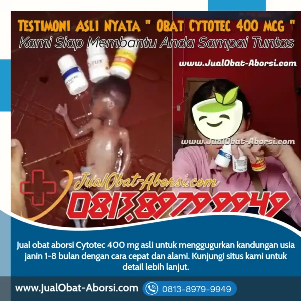 Obat Aborsi Cytotec Asli 400 mg: Solusi Aman dan Efektif untuk Mengatasi Kehamilan yang Tidak Diinginkan